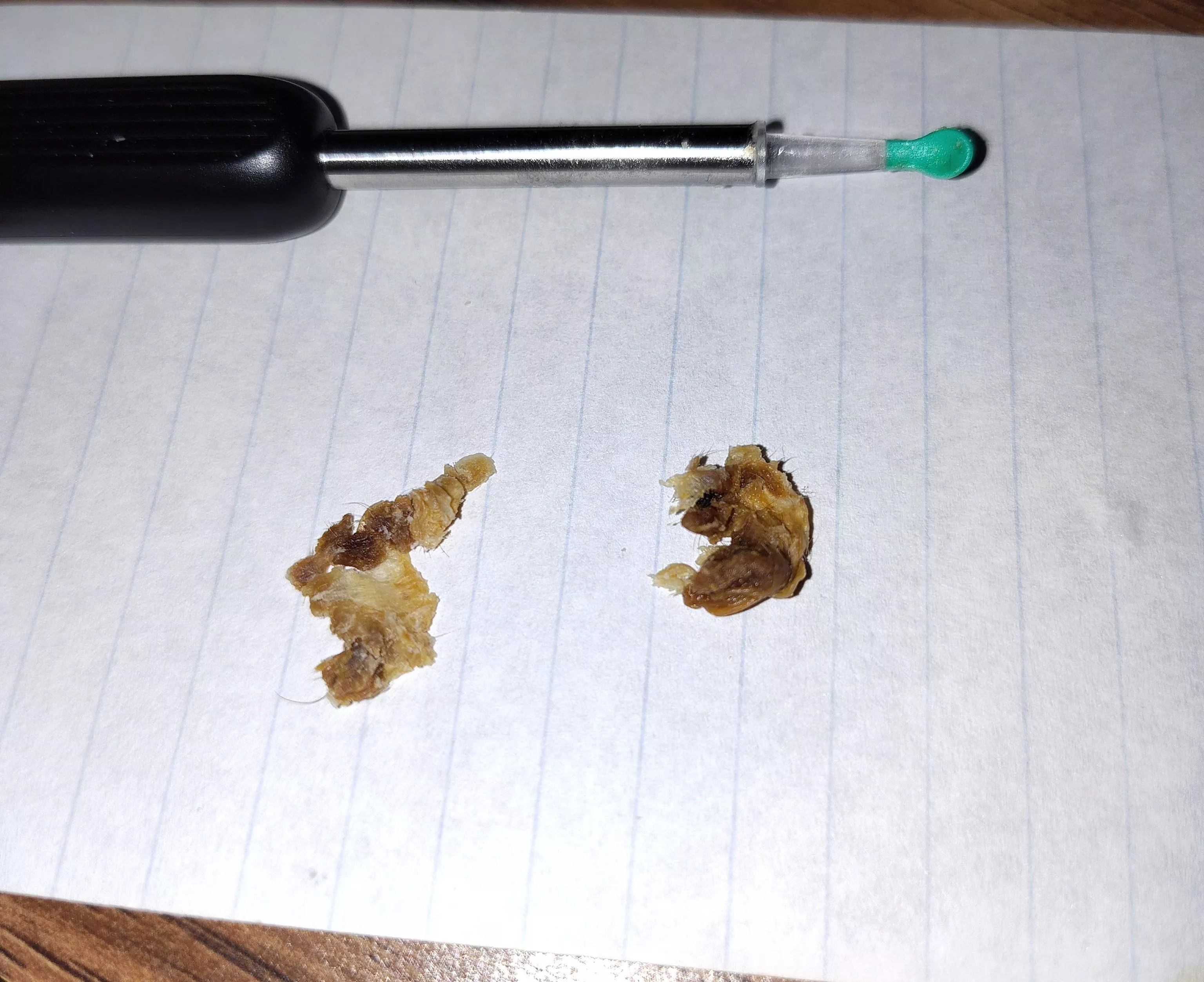 Ear gunk removed! Best $5 I have ever spent lol