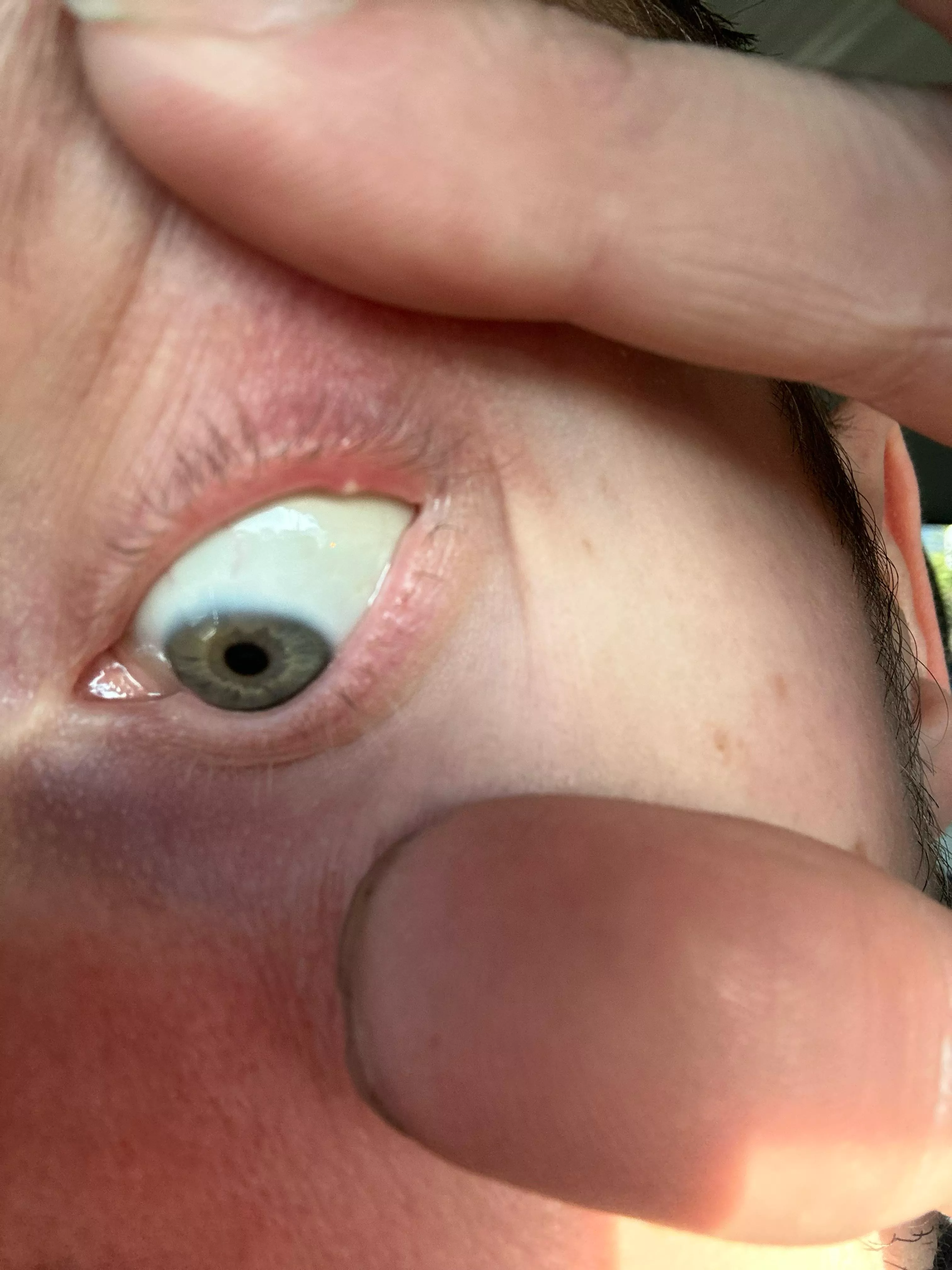 It’s on my eyeeeeeee