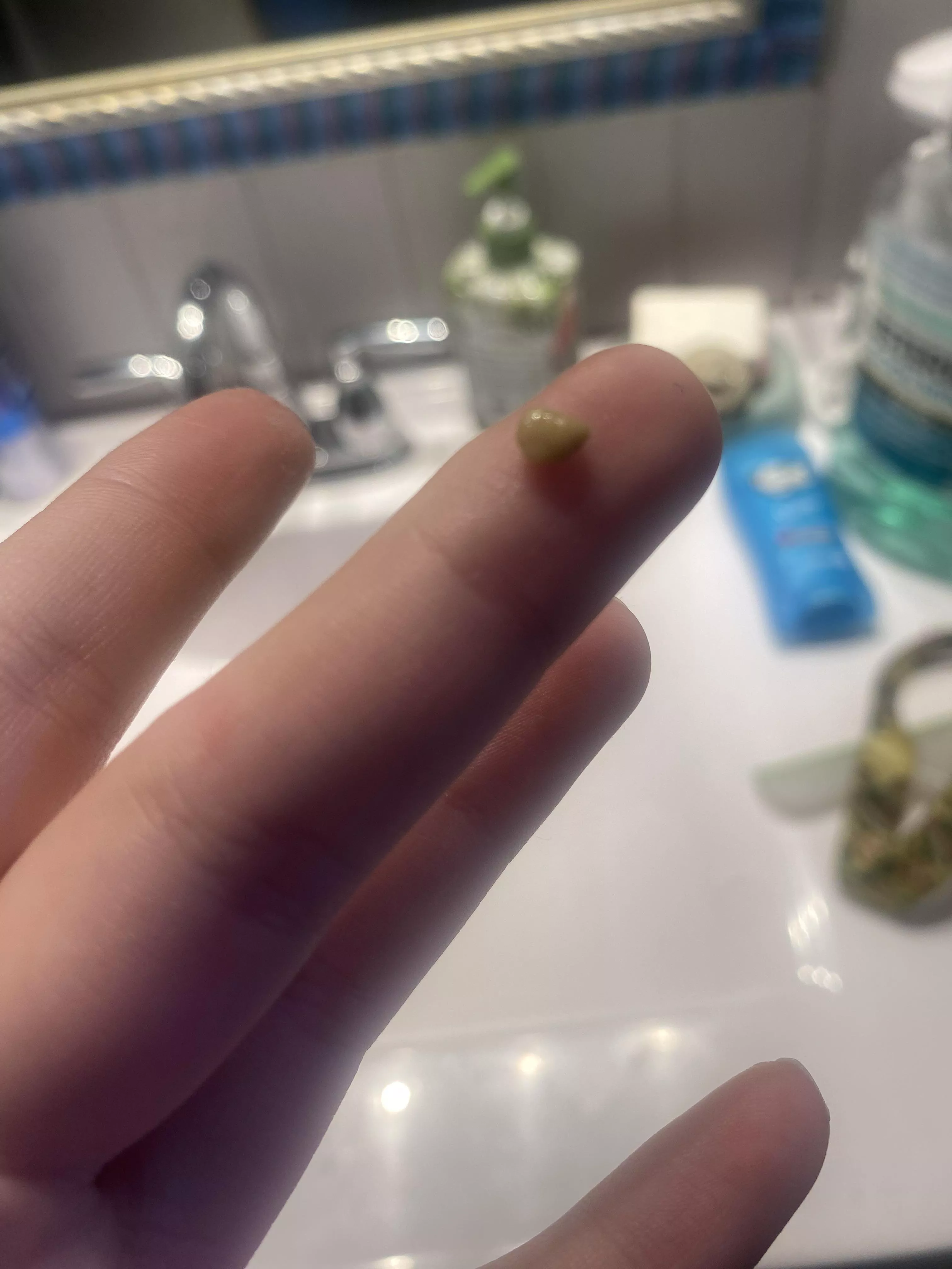 This formed overnight 😭 my tonsils are so mad. 