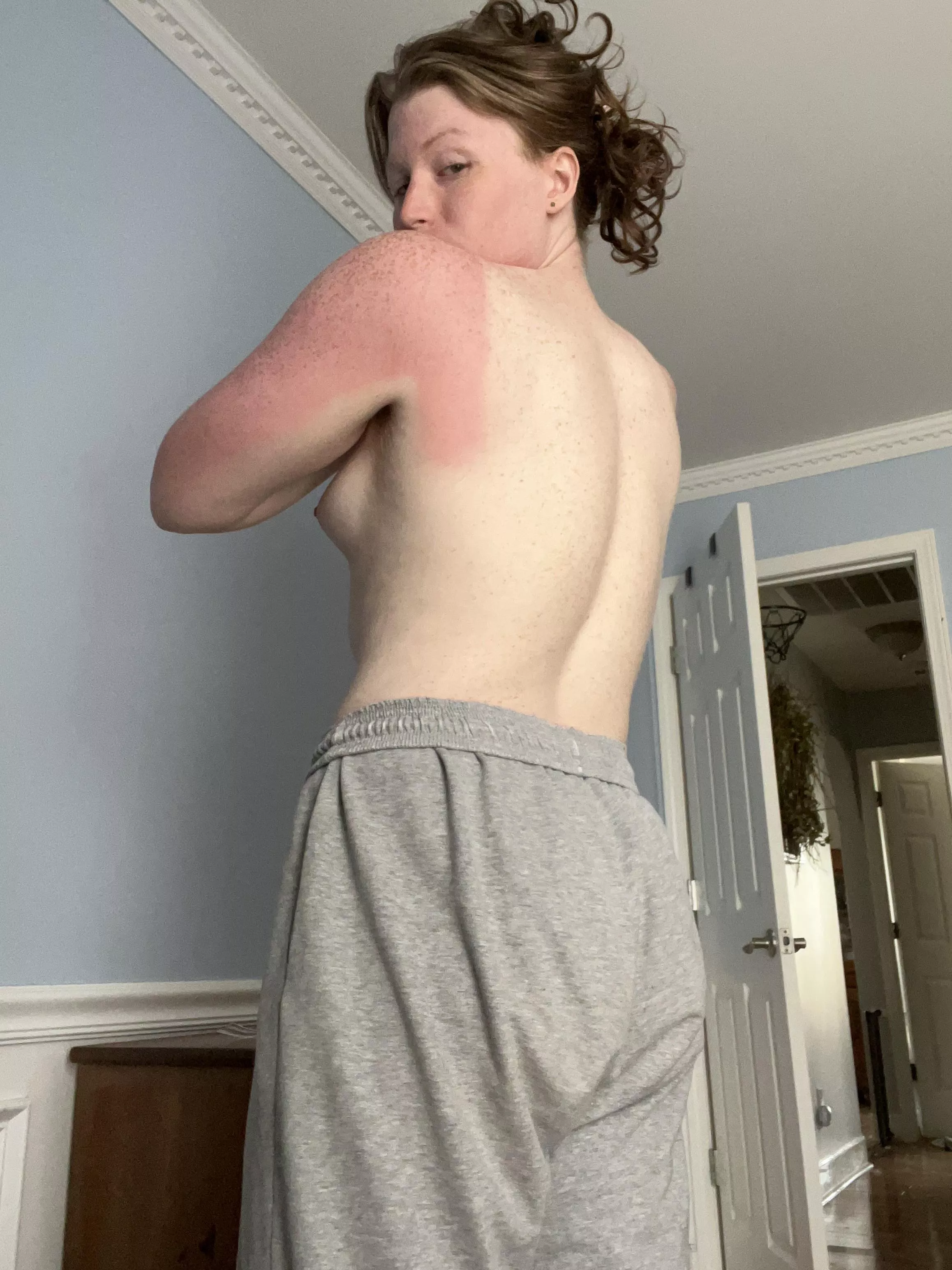 got some sun this weekend