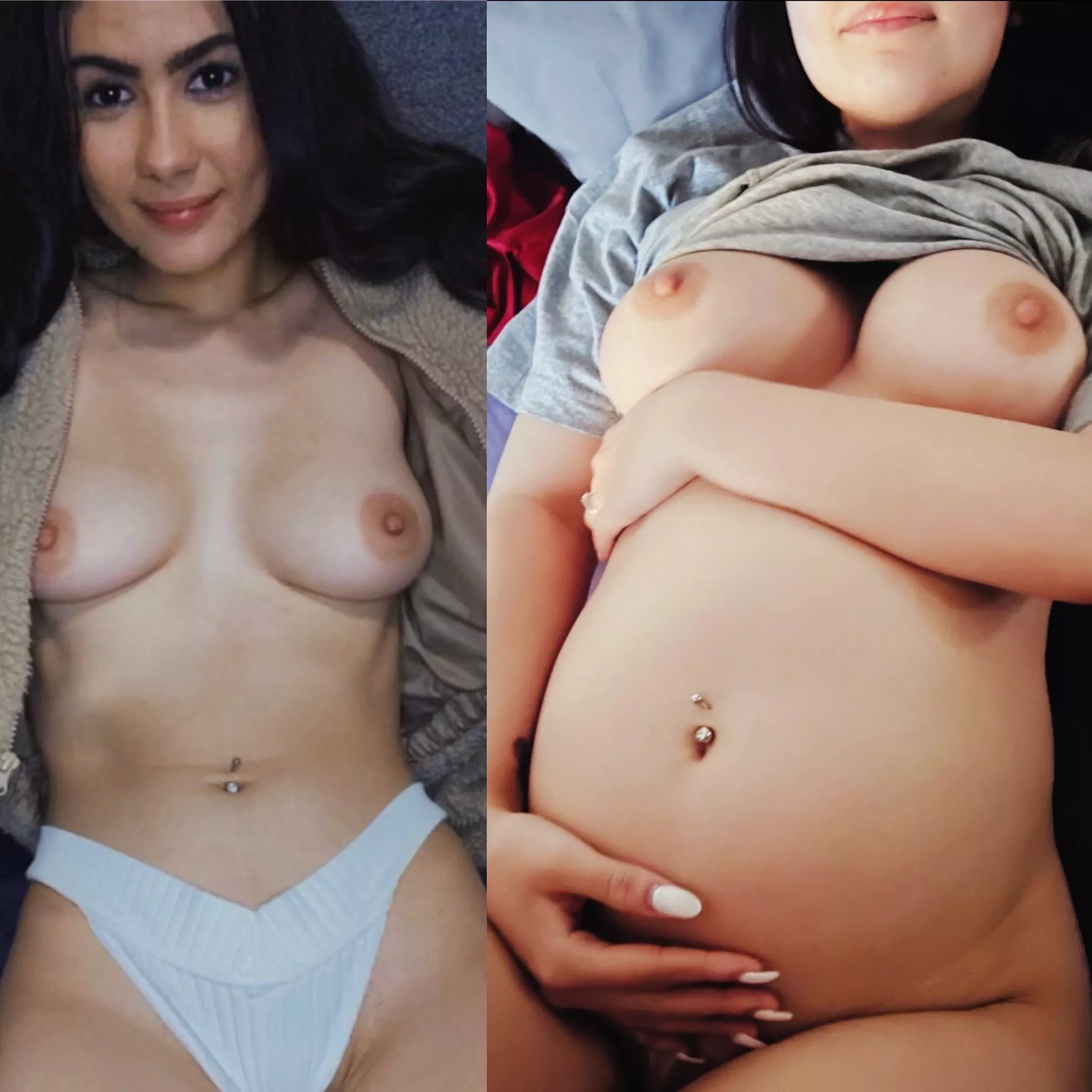 On my back before vs after.. the result of many cream pies