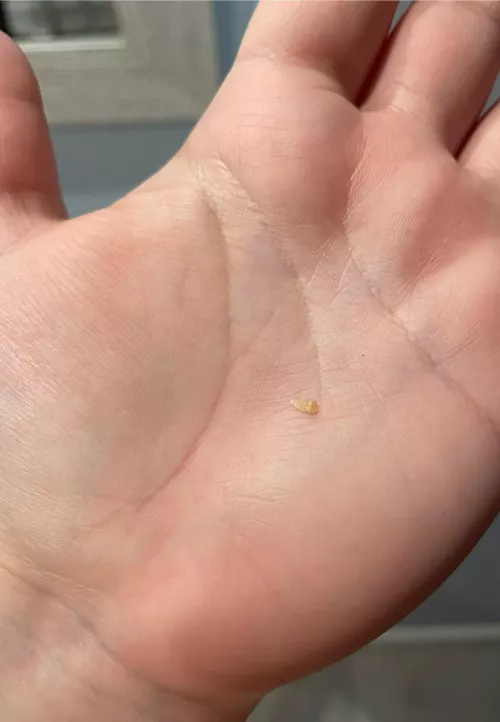 This just came out of my back