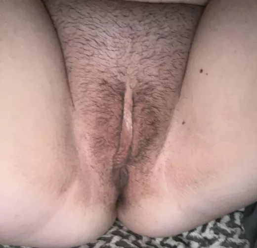 Documenting growing her back out for summer. Day 3