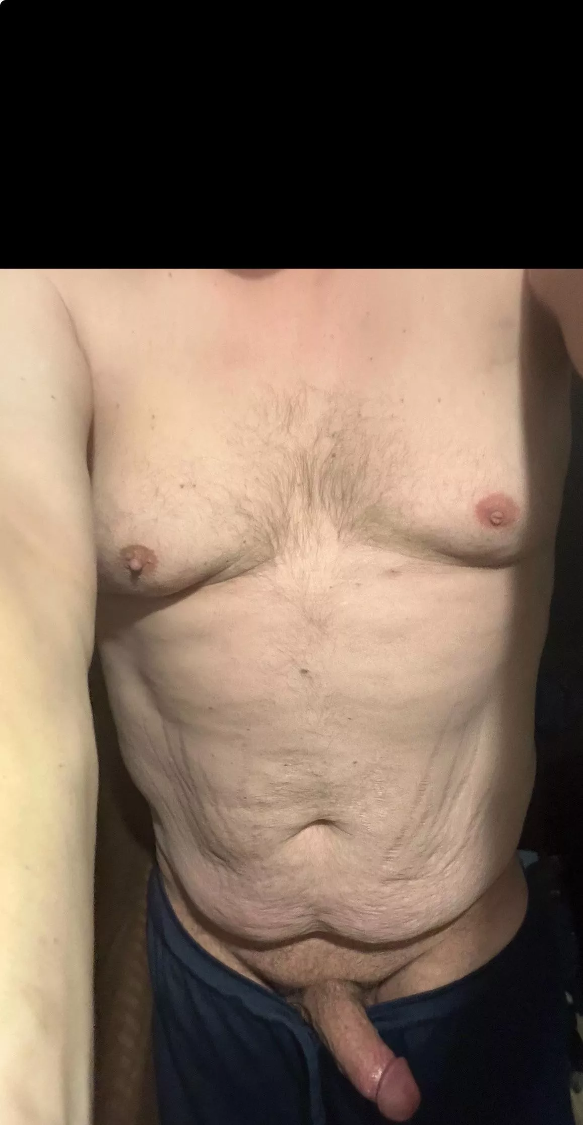 44 m , always been self conscious about my body, but this site helps