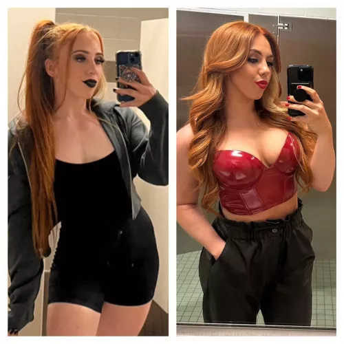 Isla Dawn Before/After Boob Job