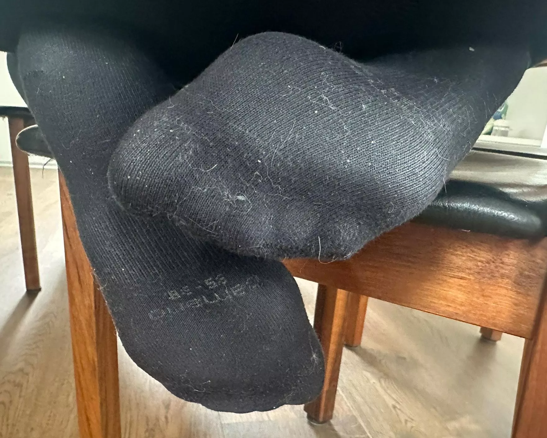 Upps I think I wore my socks too long! [F]