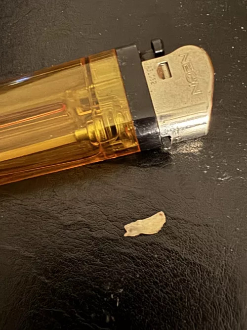 Huge Bone shard 2 years after wisdom tooth extraction