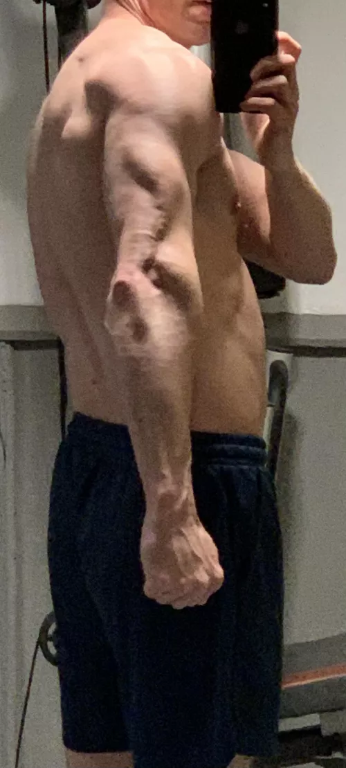 [M] Kicked by a horse