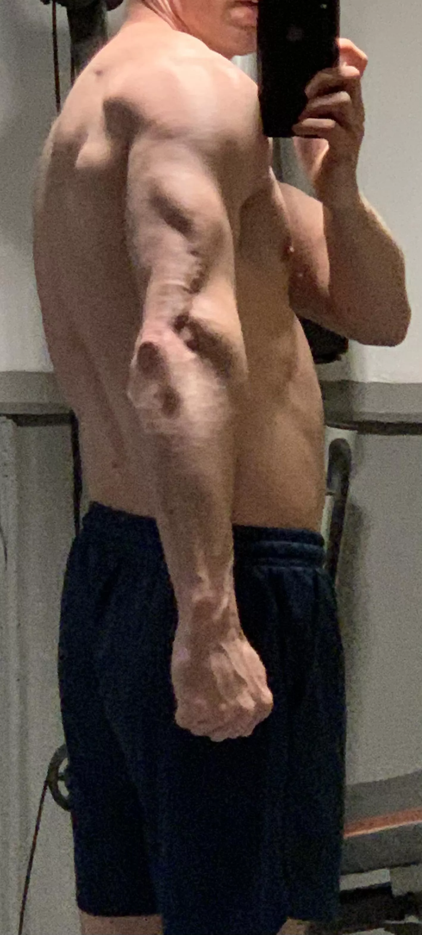 [M] Kicked by a horse