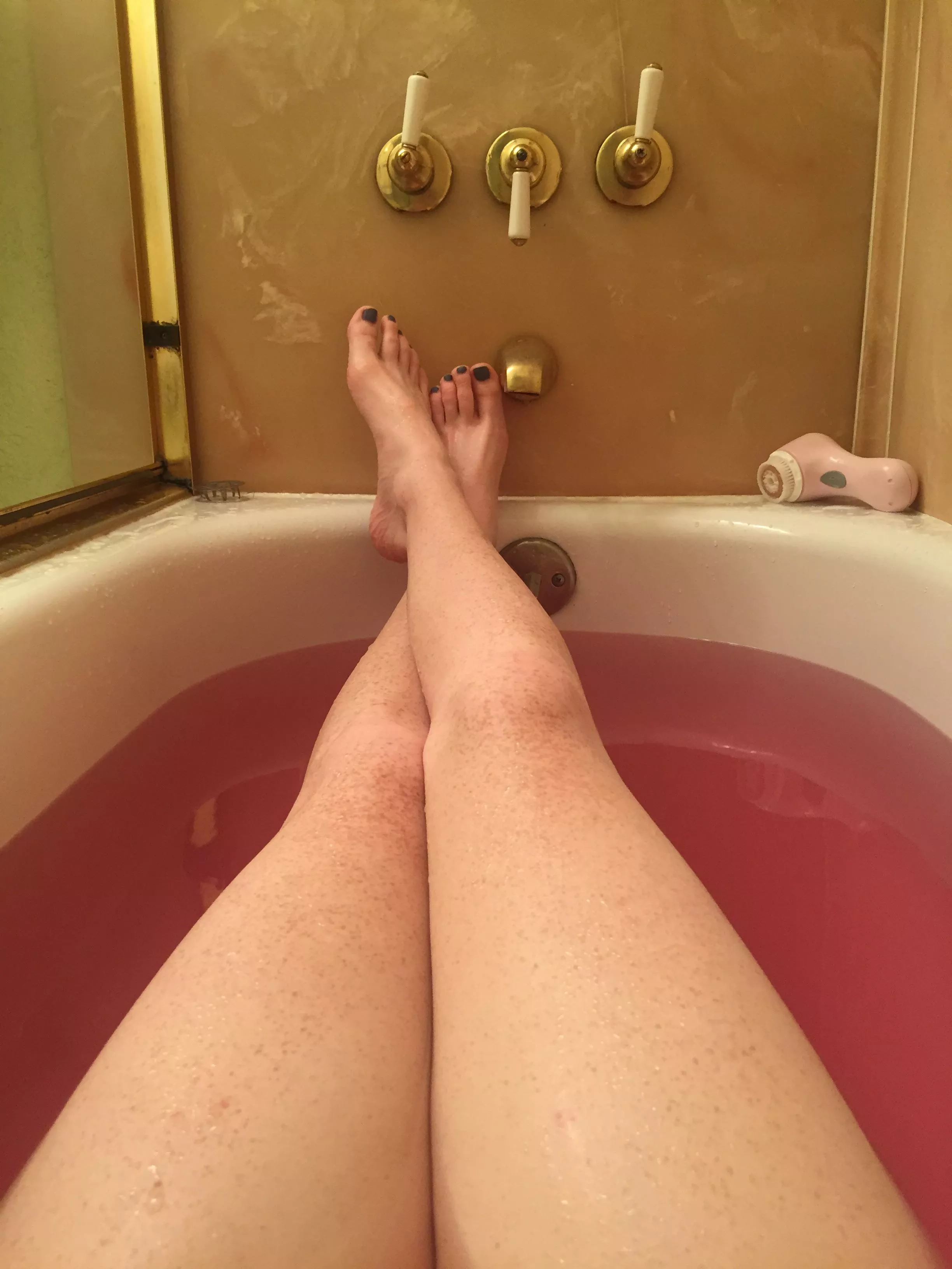 Who likes freckles on their legs