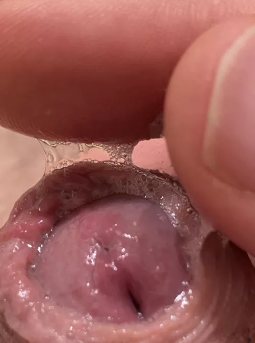 An endless supply…