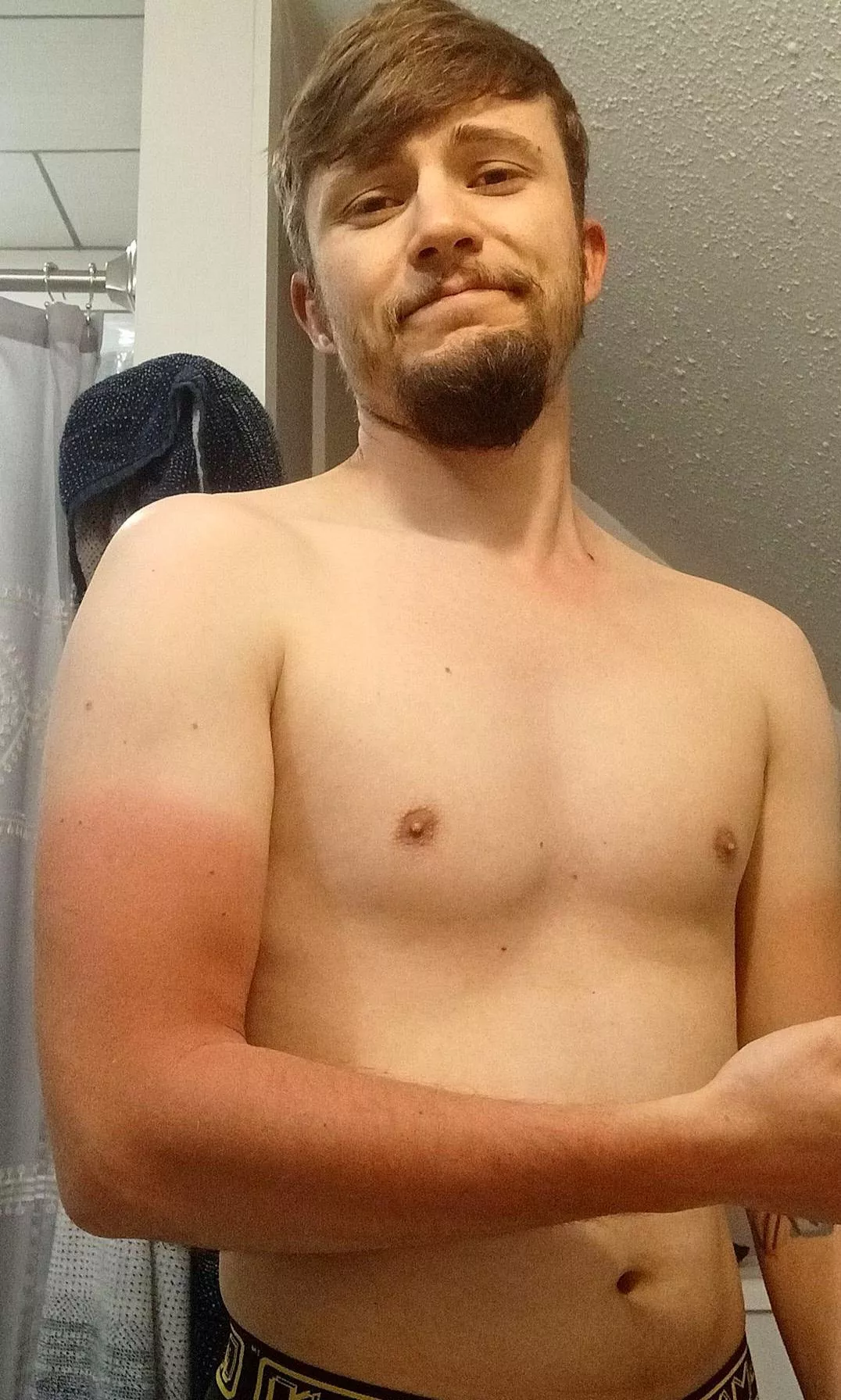 Friendly reminder to wear sunscreen. 🦞