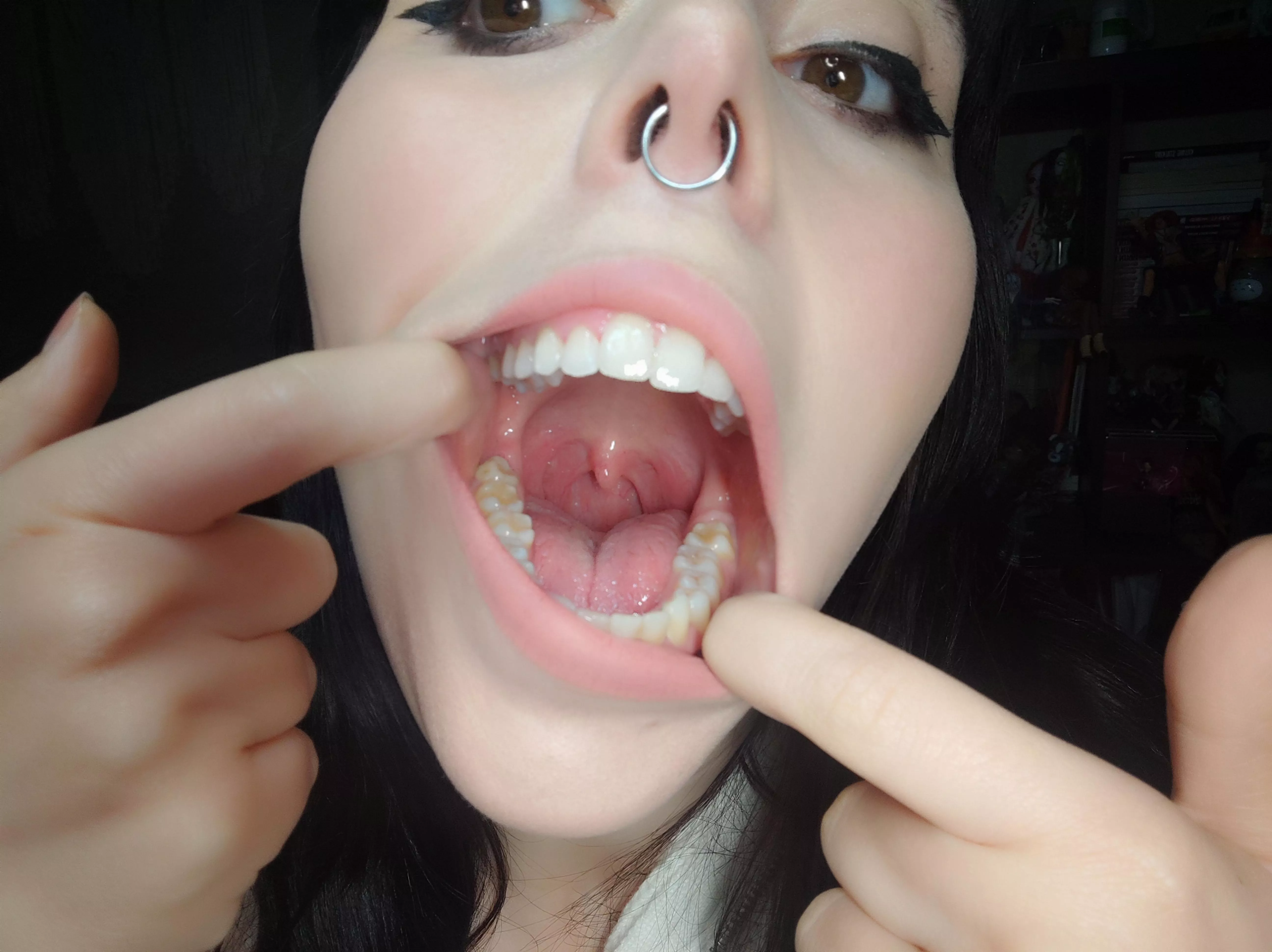 Does my uvula look good here?  :p