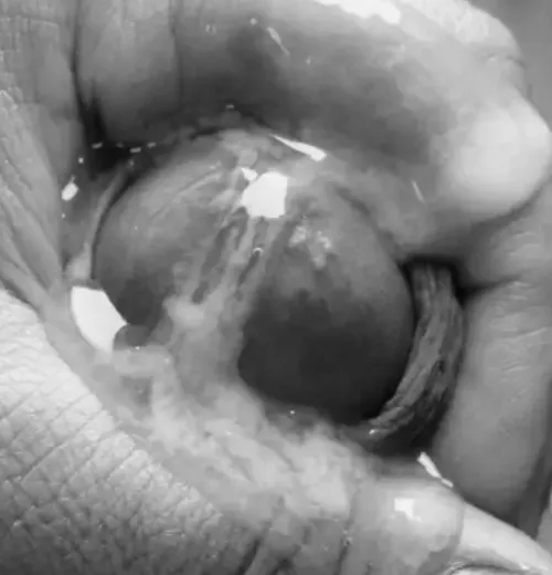 Good old Manual override (56)