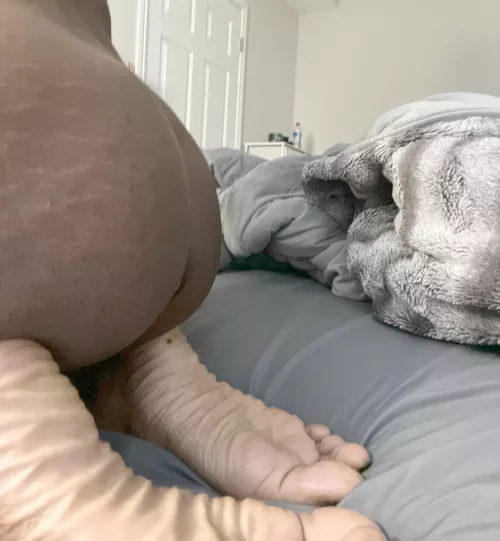 Like stretch marks? 🥹