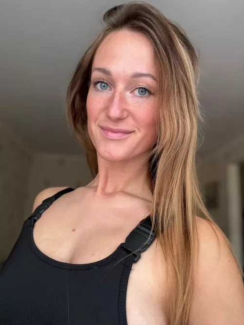 I have small freckles everywhere.. 