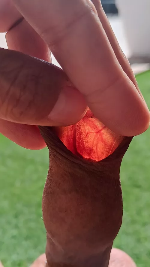 Have you ever seen your foreskin through the sun? 