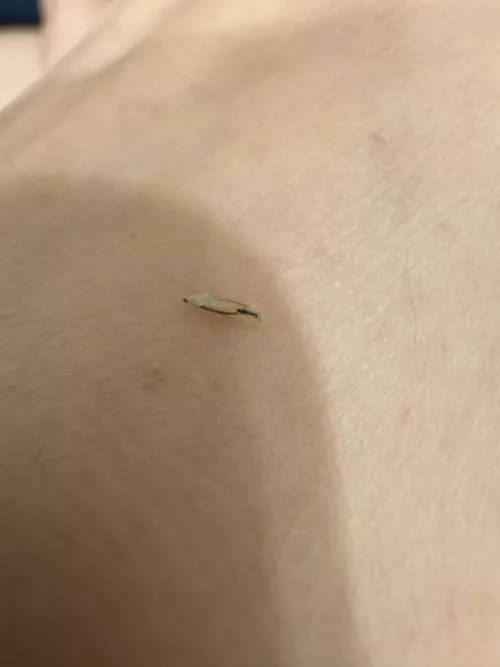 Popped an ingrown after a wax
