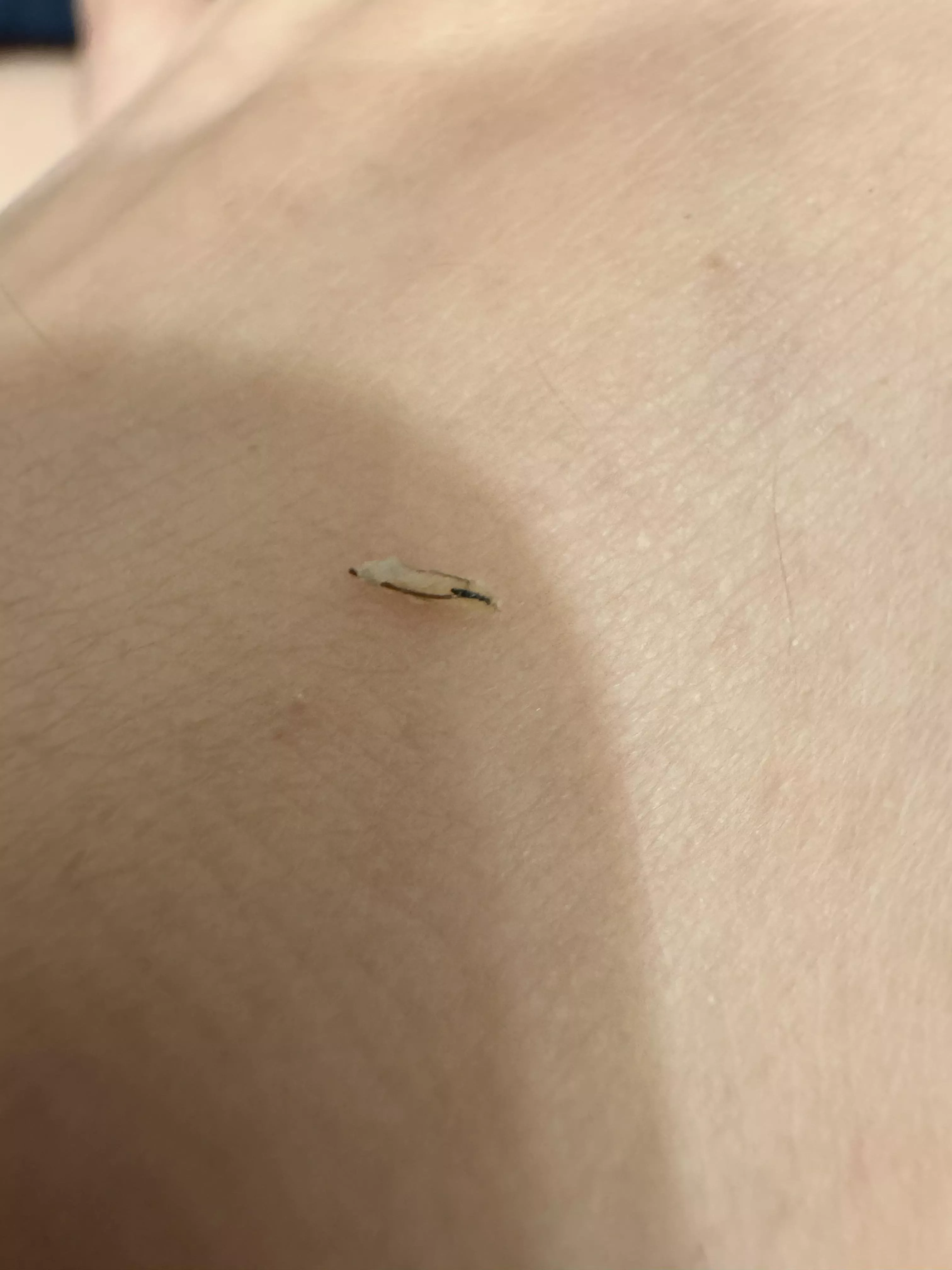 Popped an ingrown after a wax