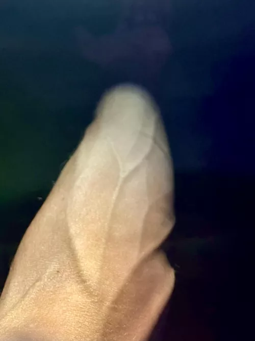 Hope you don’t mind a lil burn scar, bacon pan zapped me 🥓