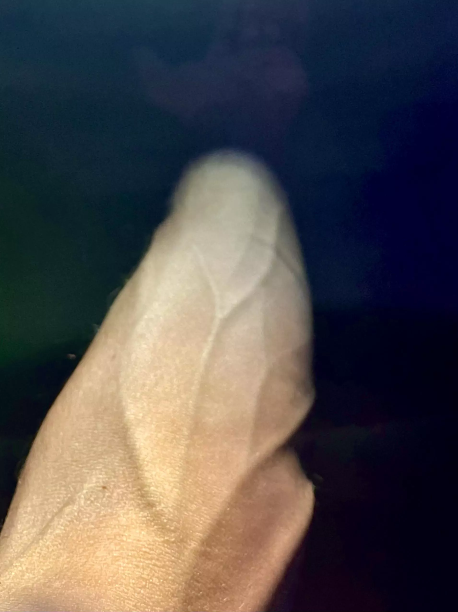 Hope you don’t mind a lil burn scar, bacon pan zapped me 🥓