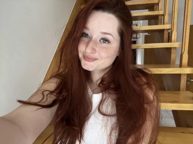 I love my freckles and I hope you like them too! [irtr]