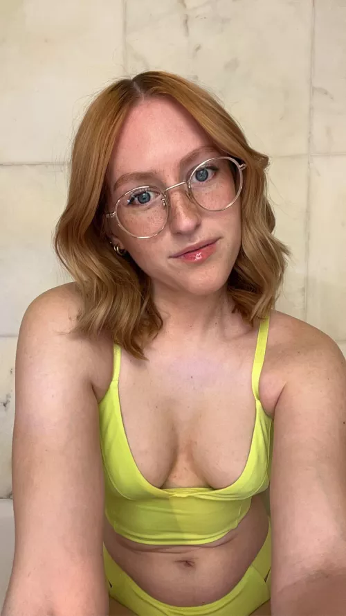 Is there such a thing as too many freckles [IRTR]