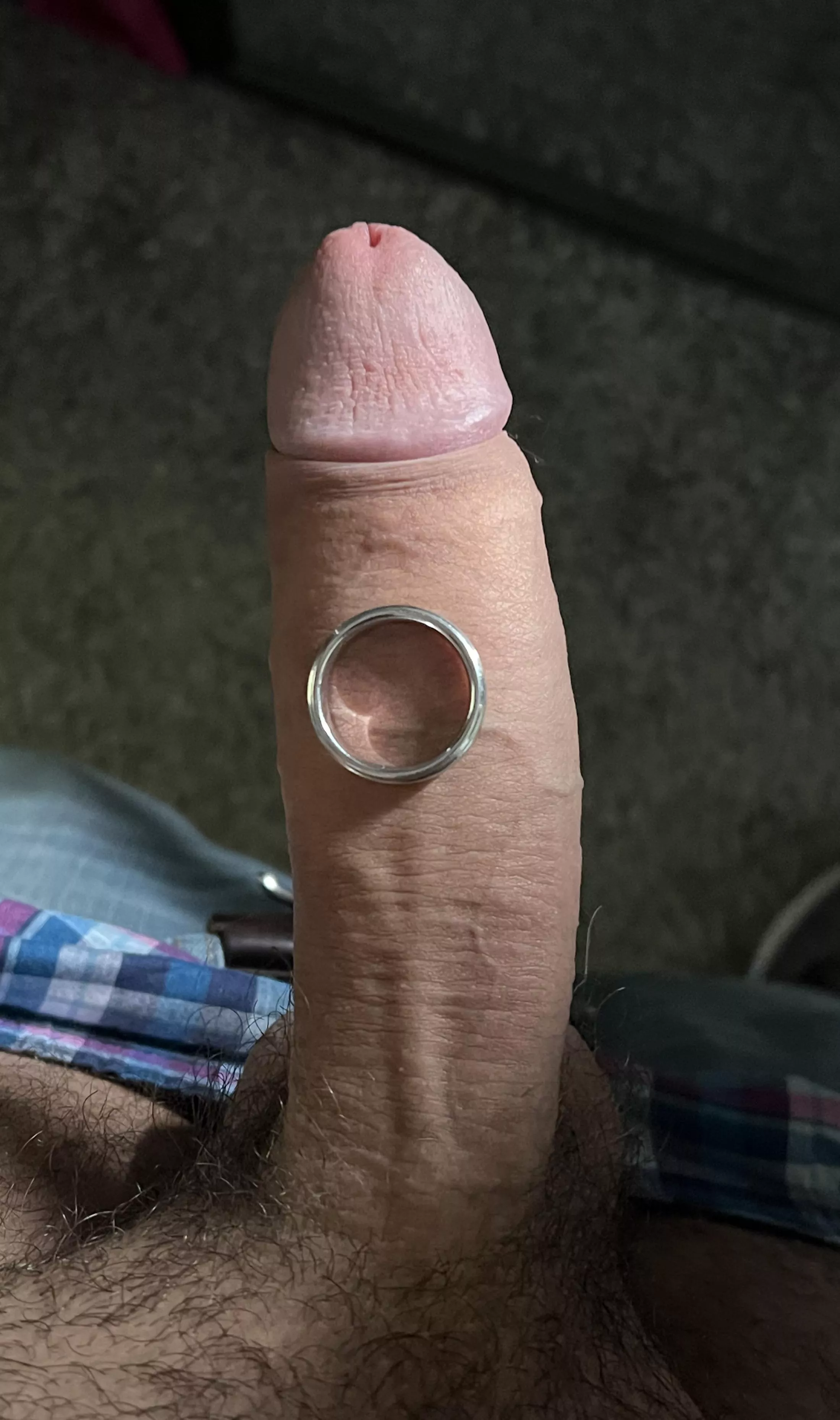 Married foreskin [43]