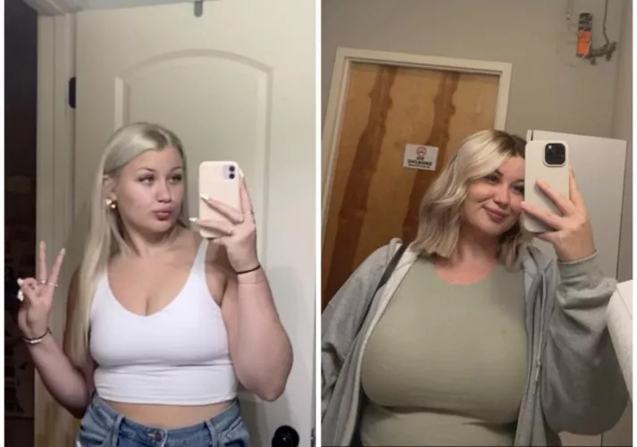 What gaining 100 pounds does to you