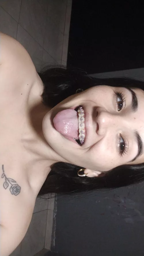 how do they look? promo they will remove my braces