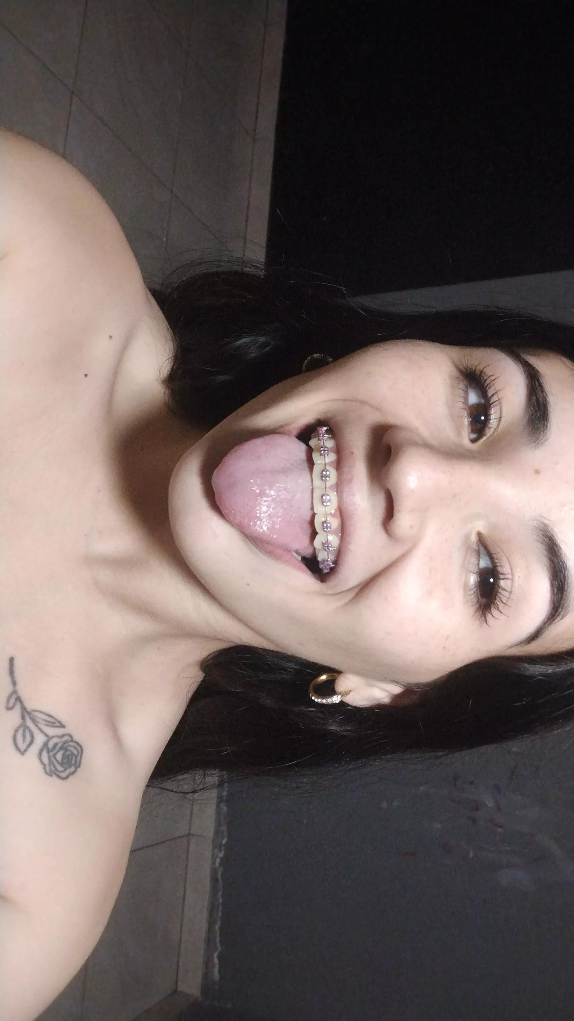 how do they look? promo they will remove my braces