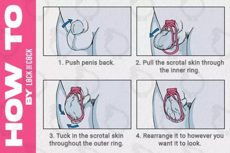 Fufu clip installation