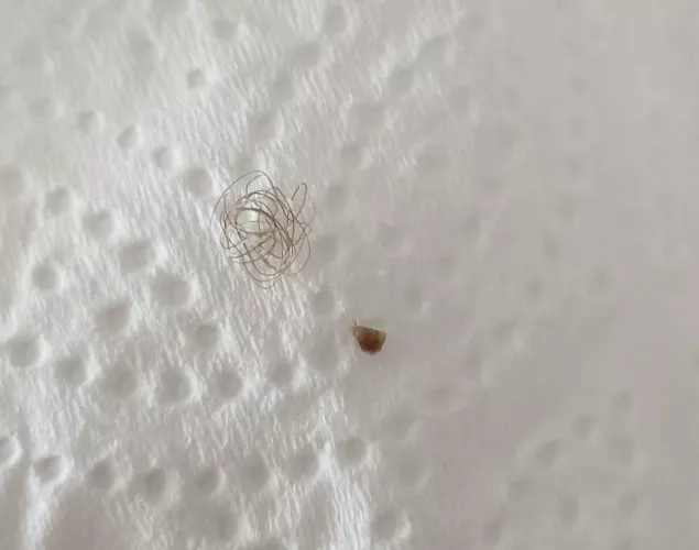 Medication made me come out in spots. Missus decided to pop some old ones whilst she was at it and this came out