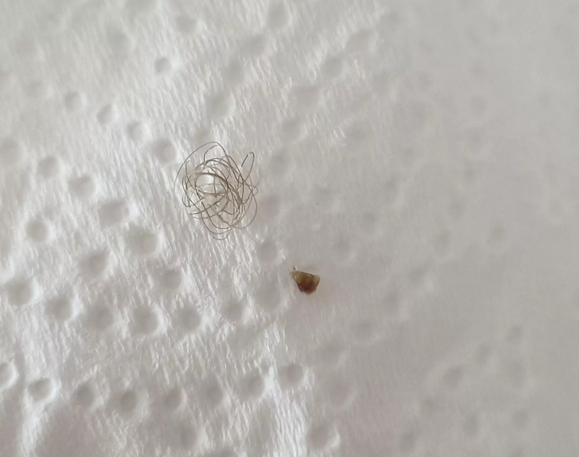 Medication made me come out in spots. Missus decided to pop some old ones whilst she was at it and this came out