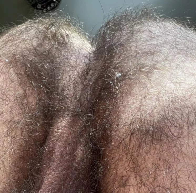 My wife thinks my hairy ass is disgusting. What do you guys think?