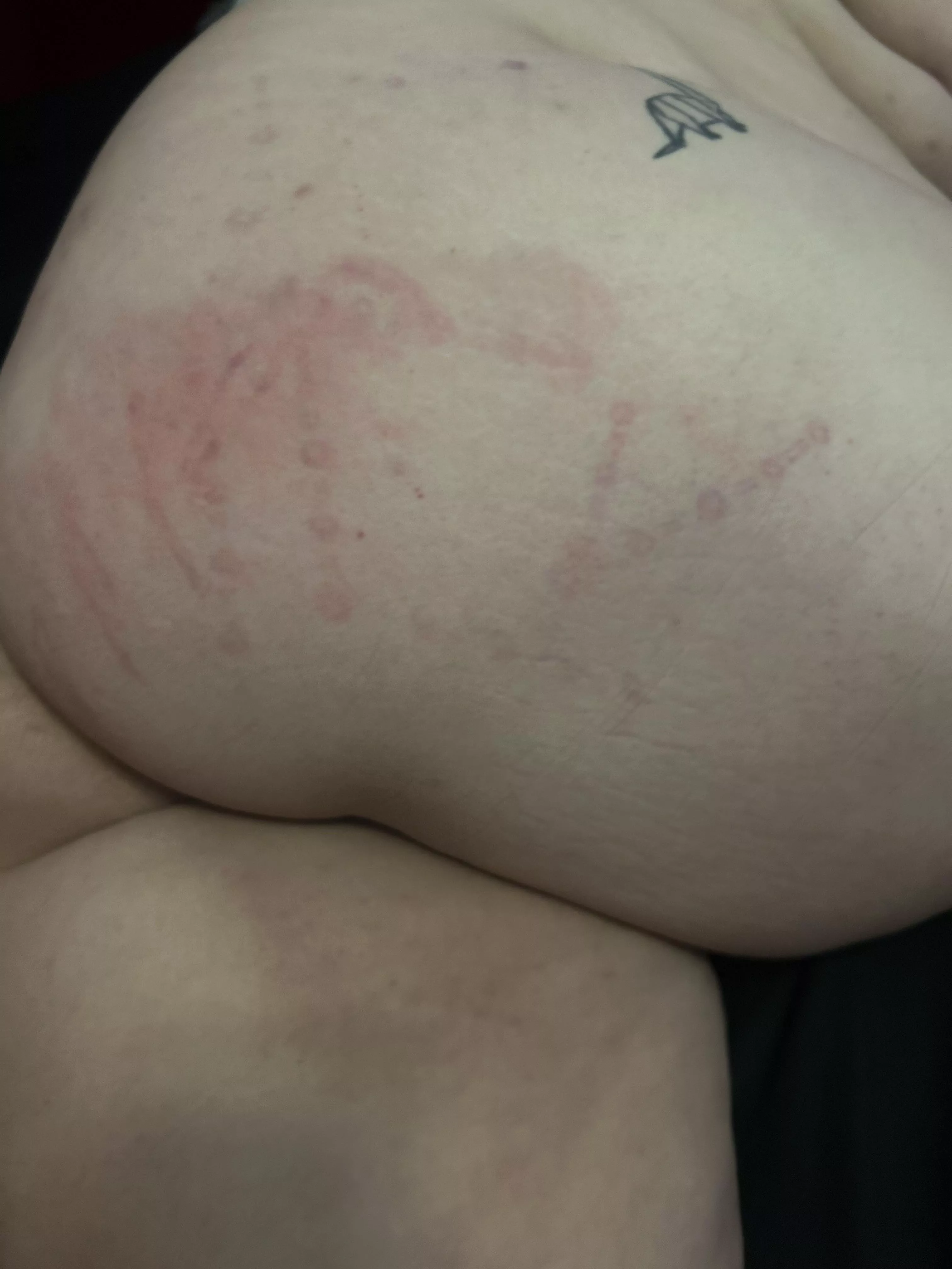 Anal beads make a funny pattern 