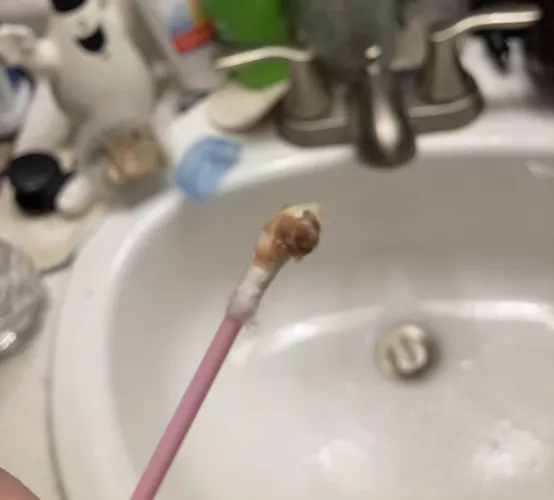 An ear infection…..AGAIN😑