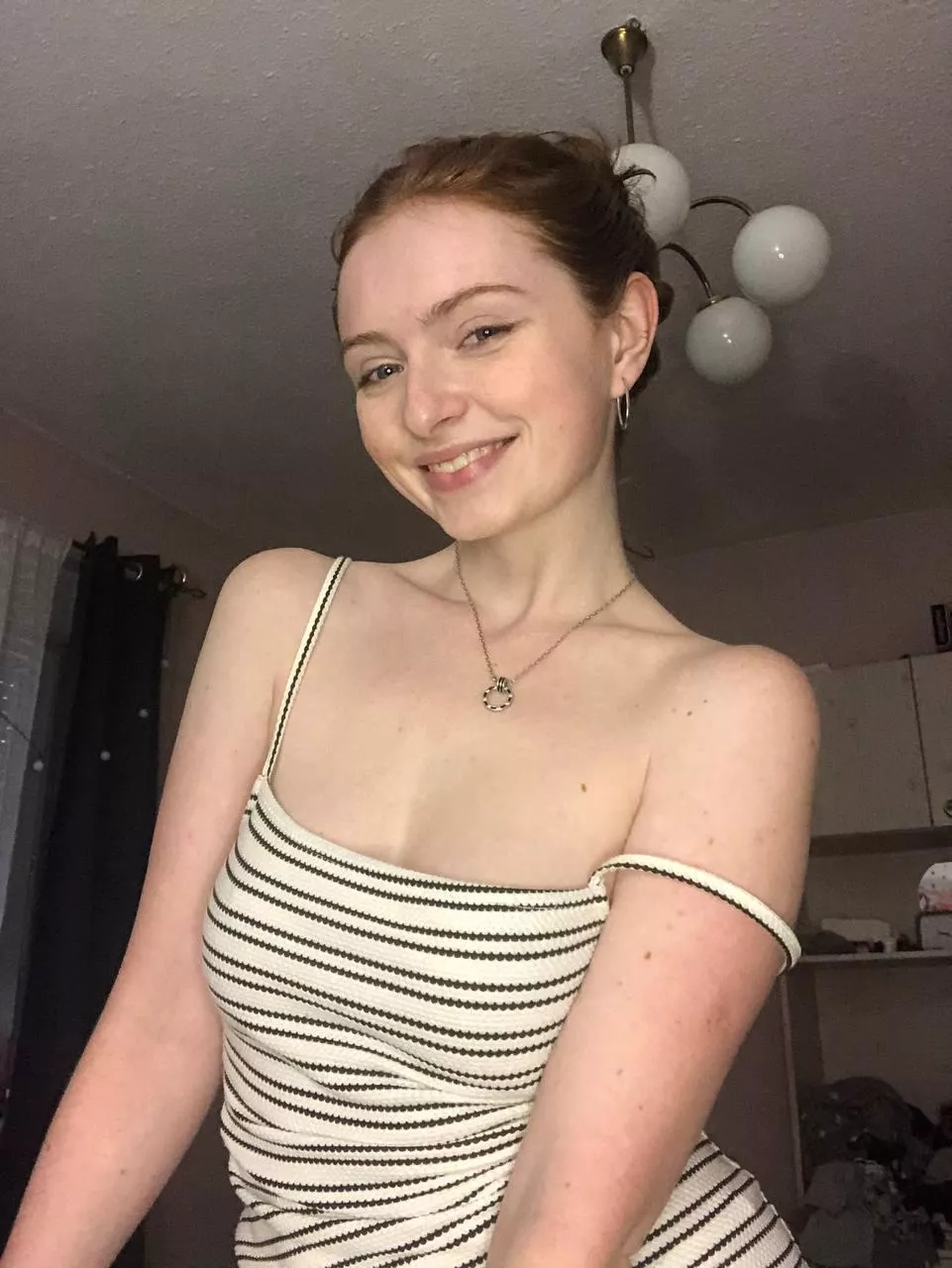 [IRTR] I have the most freckles on my hands