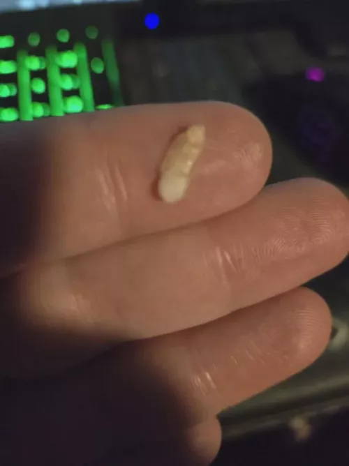 Popped out the extra bit of toenail.