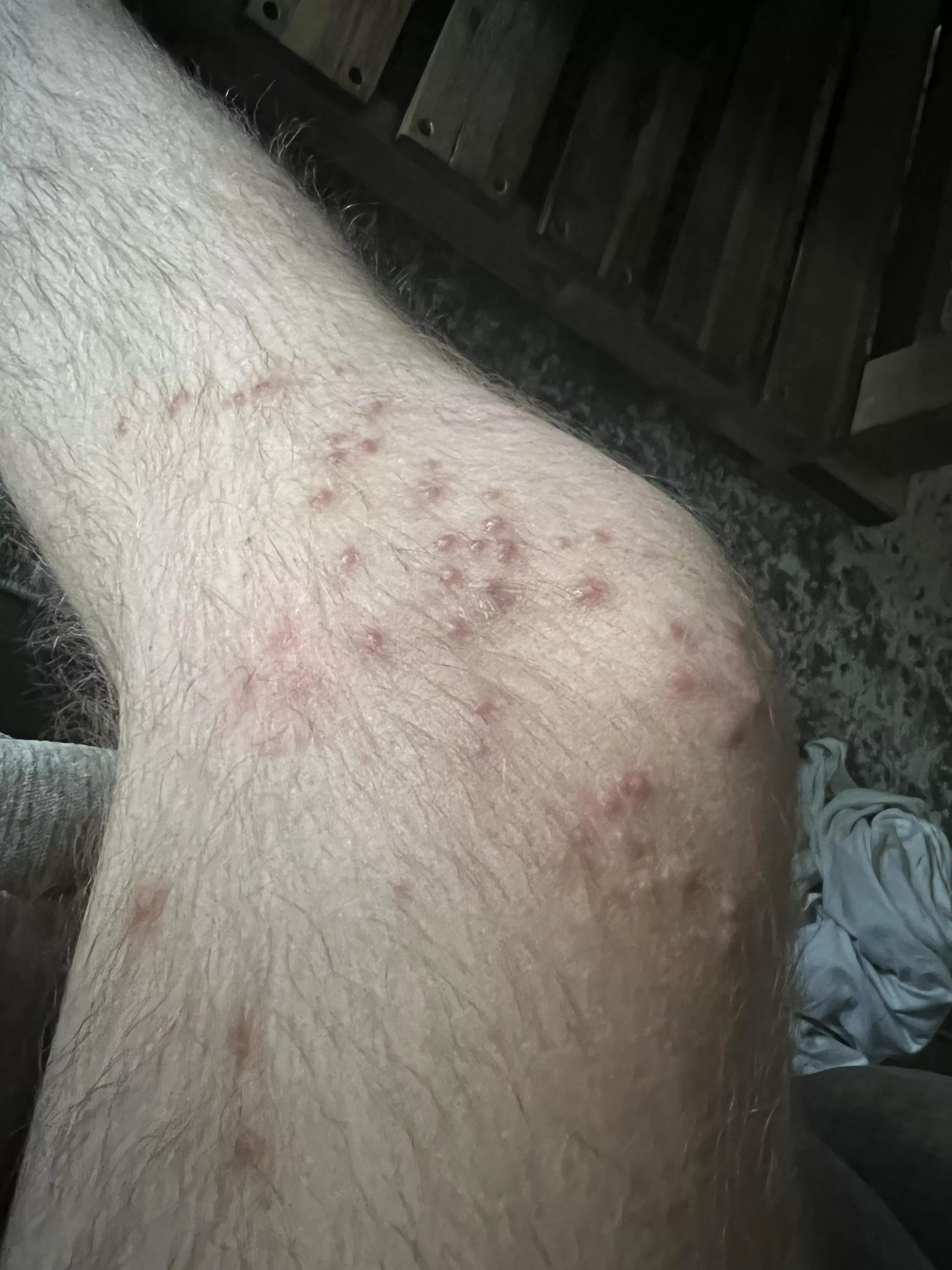 Took a knee on a fire ant hill (OC)