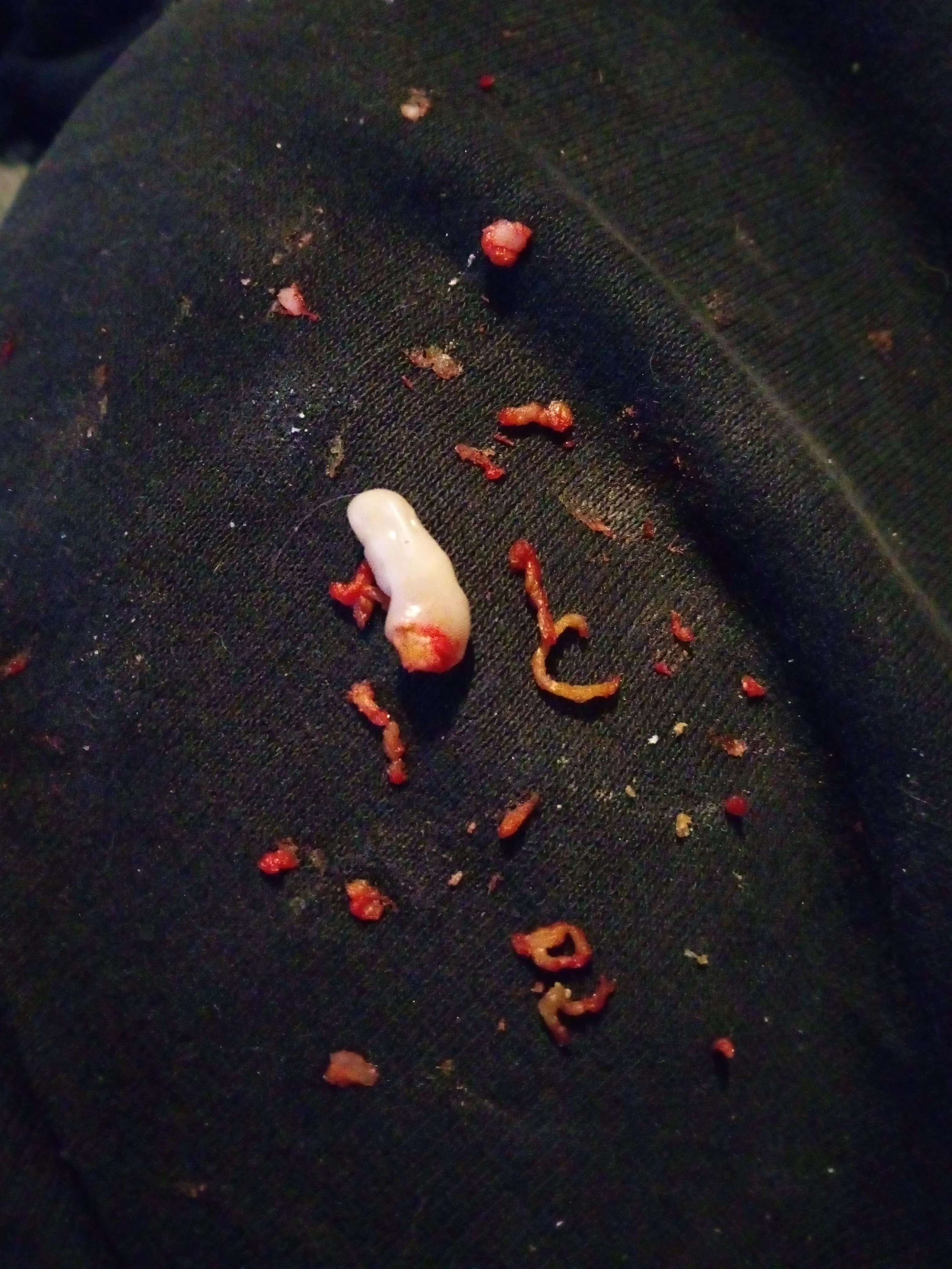 3hrs this took last night. From my scalp, yep the weird white thing too.