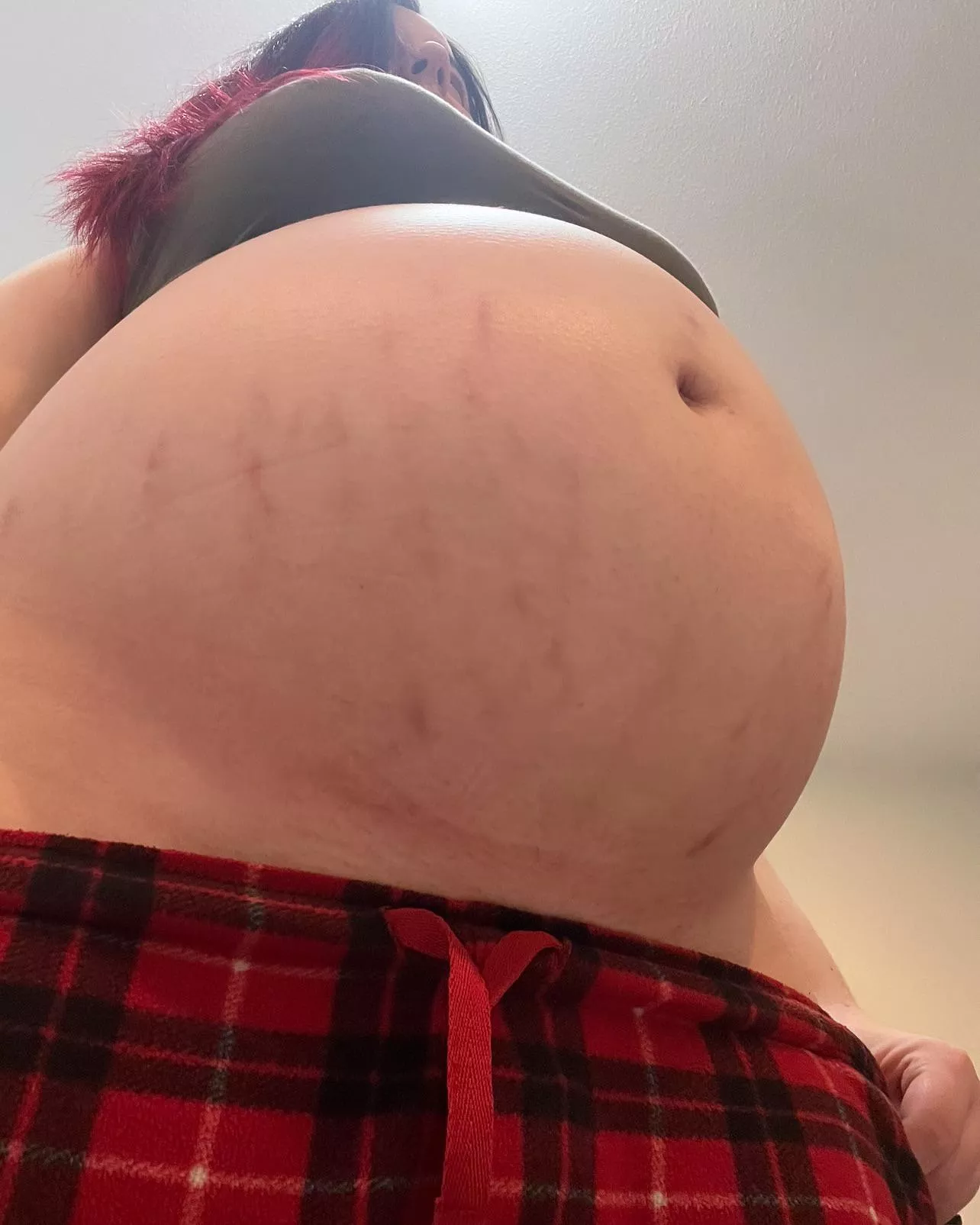 Are you ok with a few stretch marks