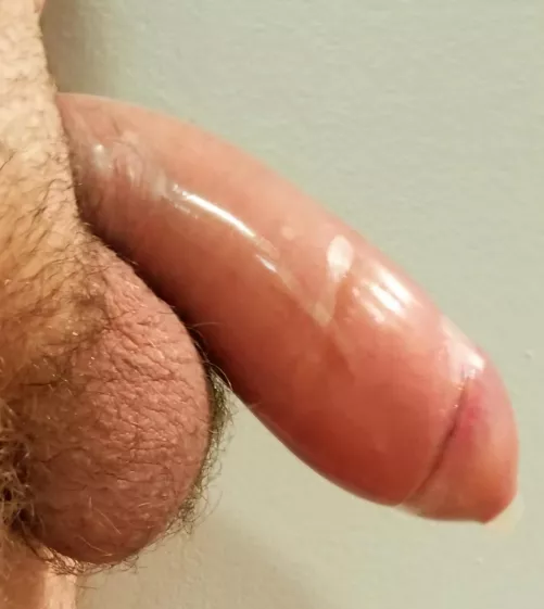 Testing the condo[m]