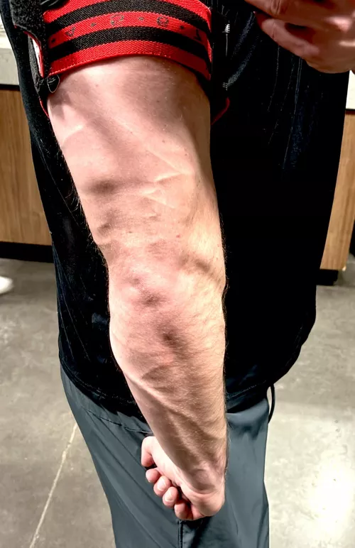 Anybody like getting pinned down? 