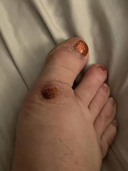 Foot “eye” update: too many people told me to stop messing with it so I decided to stop messing with it