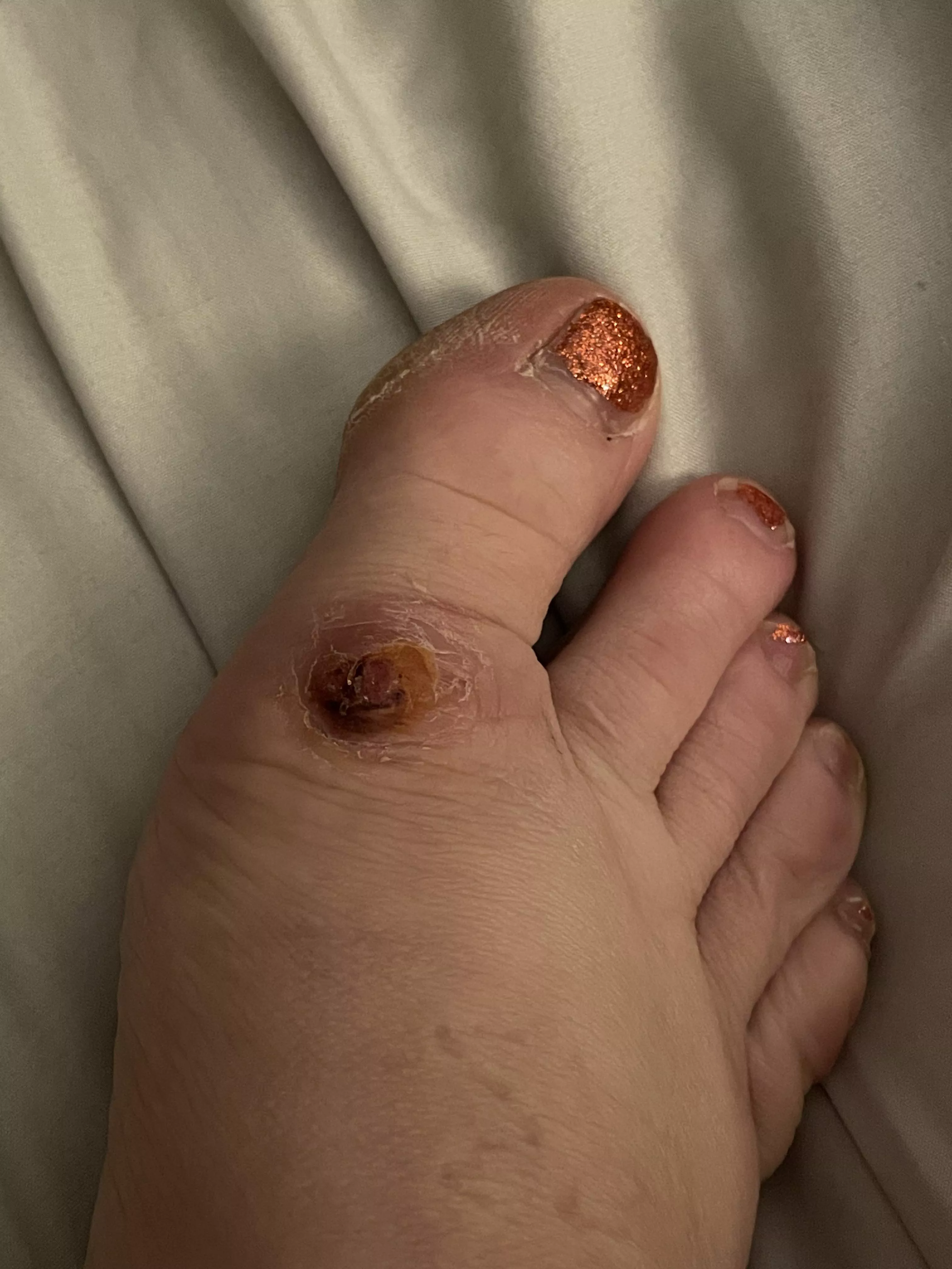 Foot “eye” update: too many people told me to stop messing with it so I decided to stop messing with it