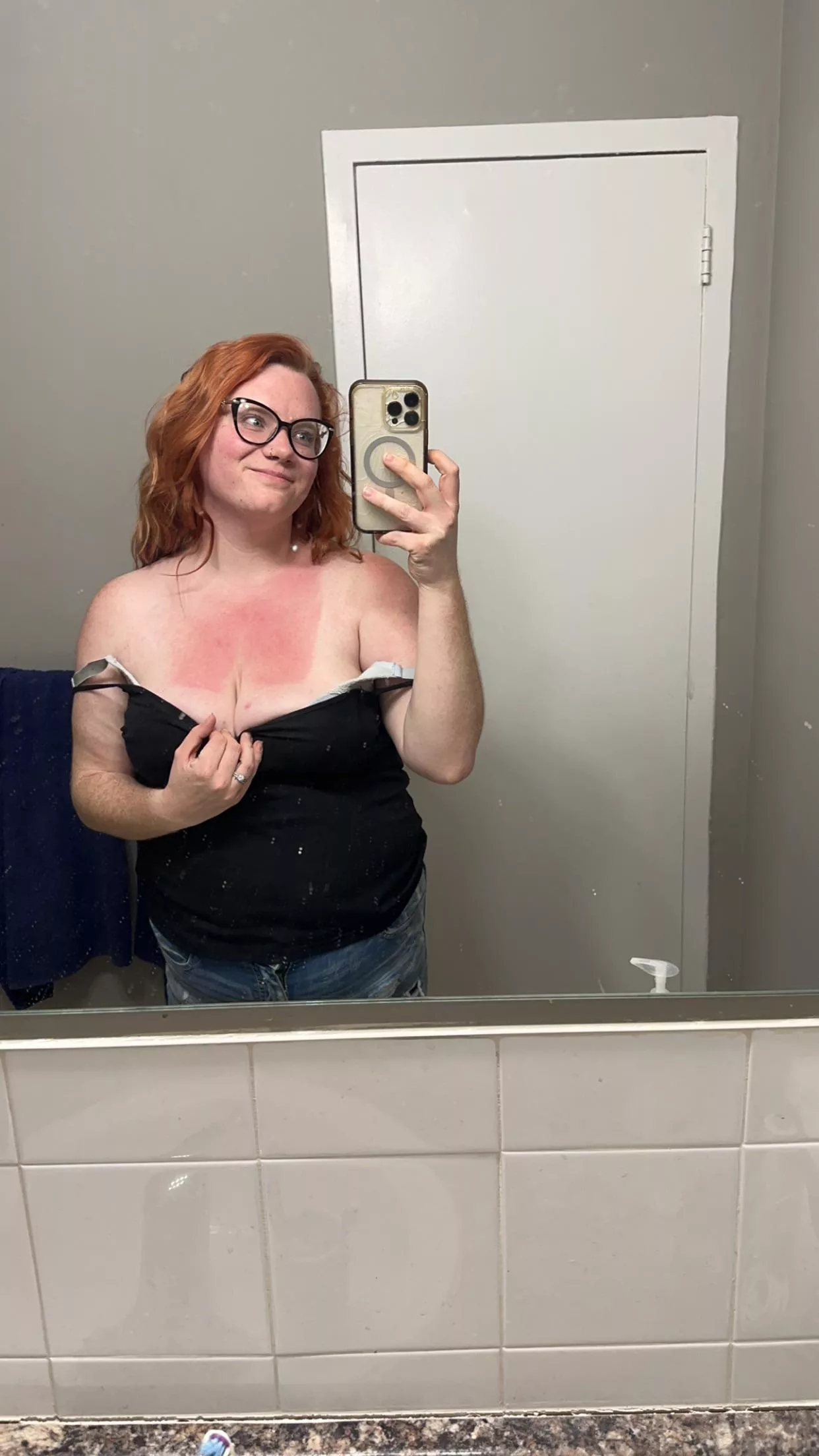 Good morning :) I got a little sunburn this weekend!