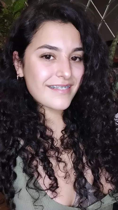 I have gotten used to my smile with braces. Do you think it would be better without them?