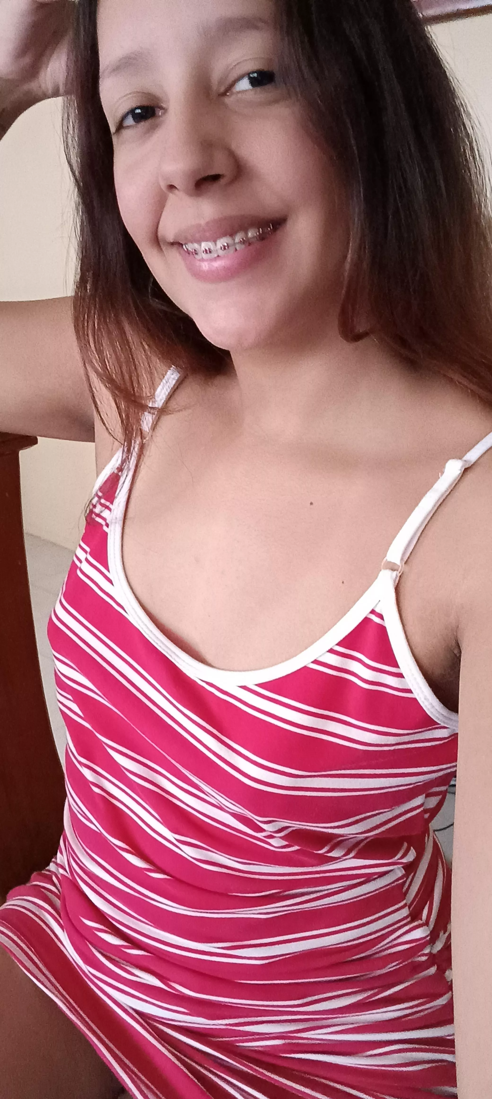 The color of my dress and the color of my braces are the same.