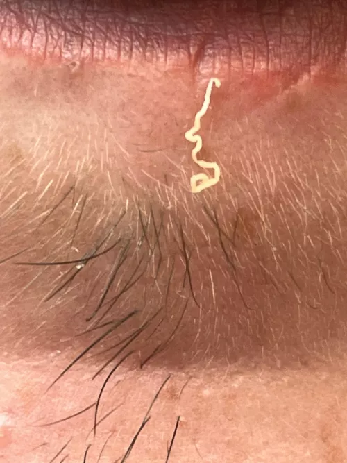 Satisfiying pop on lower lip